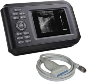 US-B20A Full Digital Handheld Ultrasound